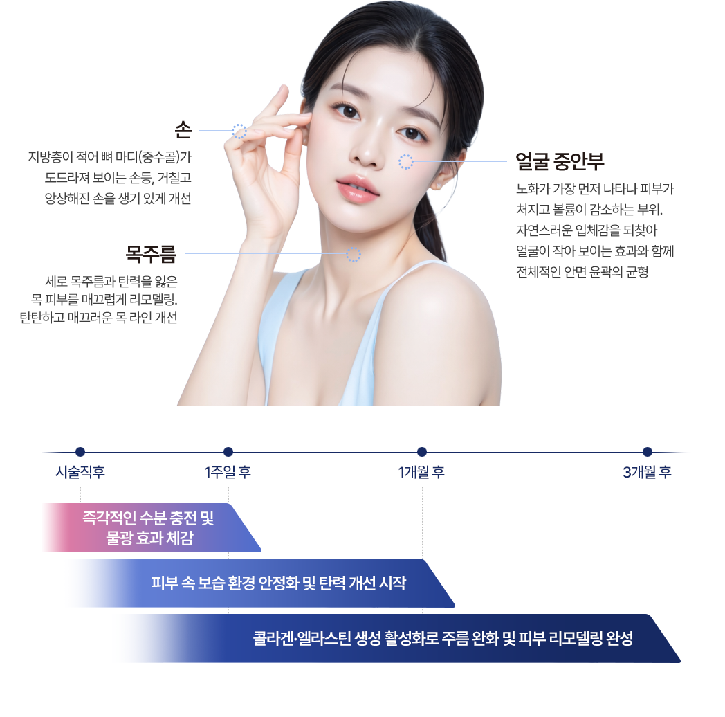 手部 – 因脂肪層較少，導致骨節（掌骨）顯得突出的手背，以及粗糙、乾瘦的手部，都能透過治療恢復生氣與活力。| 臉部中間區域 – 這是老化最先表現出的部位，皮膚會鬆弛且缺乏膨脹感。透過恢復自然的立體感，不僅能讓臉部看起來更小，還能調整整個臉部的輪廓平衡。| 頸部皺紋 – 能夠平滑處理縱向的頸部皺紋，以及失去彈性的頸部皮膚，讓頸部線條更加緊實光滑。