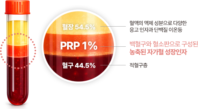 血漿 54.5% – 血液中的液態成分，含有各種凝血因子、蛋白質及離子等 | PRP 1% – 由白血球和血小板所構成的濃縮型自體血液生長因子 | 血球 44.5% – 紅血球層